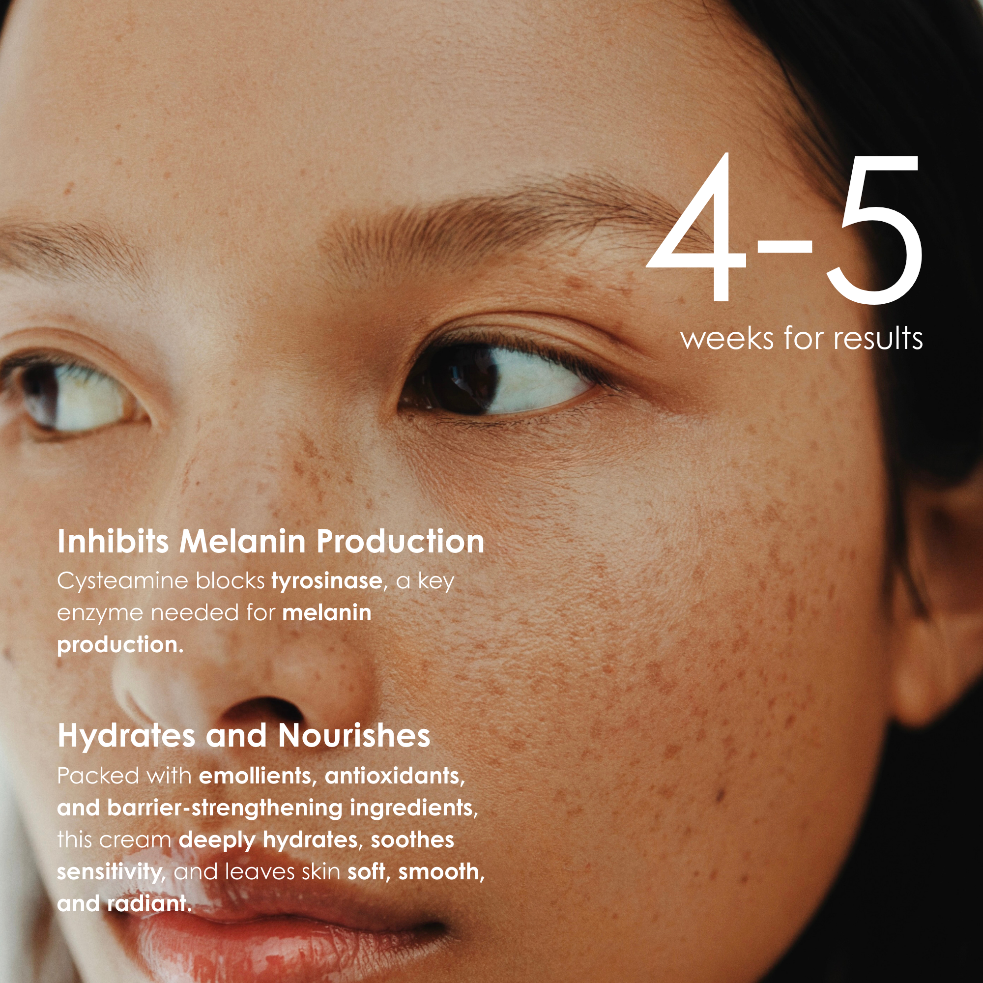 Omic+ 7.5% Cysteamine Cream 30ml